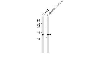 Western blot analysis of lysates from human heart and skeletal muscle tissue lysate(from left to right), using FABP3 Antibody (ABIN6242886 and ABIN6577405). (FABP3 anticorps  (AA 1-133))