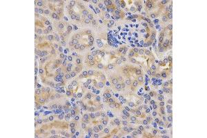 Immunohistochemistry of paraffin-embedded mouse kidney using CFB antibody at dilution of 1:200 (x400 lens)
