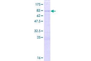 Image no. 1 for DAP3 Binding Cell Death Enhancer 1 (DELE1) (AA 1-515) protein (GST tag) (ABIN6923018)