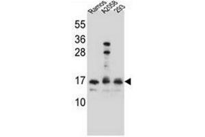 Western blot analysis of Homeodomain-only protein / HOP Antibody  in Ramos,A2058,293 cell line lysates (35ug/lane). (HOPX anticorps  (C-Term))