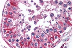 anti-Peptidyl-tRNA Hydrolase 2 (PTRH2) (N-Term) antibody