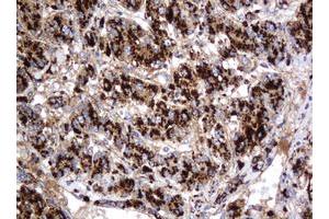 Image no. 7 for anti-Galactosidase, beta 1 (GLB1) antibody (ABIN1498467)