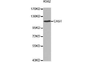 Western blot analysis of extracts of K562 cell line, using CAST antibody. (Calpastatin anticorps  (C-Term))