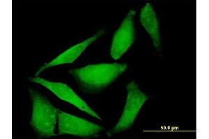 Immunofluorescence of purified MaxPab antibody to FBXO40 on HeLa cell.