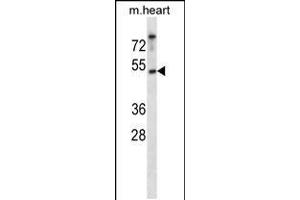 Western blot analysis in mouse heart tissue lysates (35ug/lane). (CK1 epsilon anticorps  (C-Term))