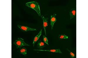 IF analysis of Cyclophilin E/PPIE using anti-Cyclophilin E/PPIE antibody (ABIN7599243). (PPIE anticorps  (AA 1-301))