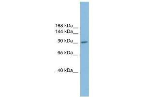 PIWIL2 antibody used at 1 ug/ml to detect target protein. (PIWIL2 anticorps)