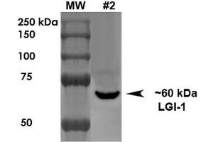 Western Blot analysis of Rat Brain Membrane showing detection of ~60 kDa LGI1 protein using Mouse Anti-LGI1 Monoclonal Antibody, Clone S283-7 . (LGI1 anticorps  (AA 37-113) (Atto 390))