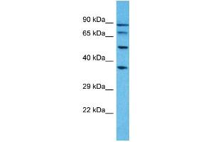 Western Blotting (WB) image for anti-Pseudouridylate Synthase 7 Homolog-Like (PUS7L) (N-Term) antibody (ABIN2791889) (PUS7L anticorps  (N-Term))