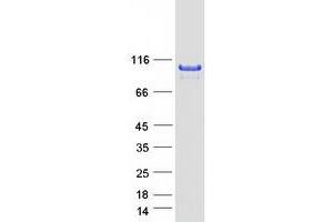 Validation with Western Blot