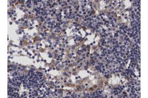 ABIN6266689 at 1/100 staining human Lymph node tissue sections by IHC-P. (TP53I11 anticorps  (N-Term))
