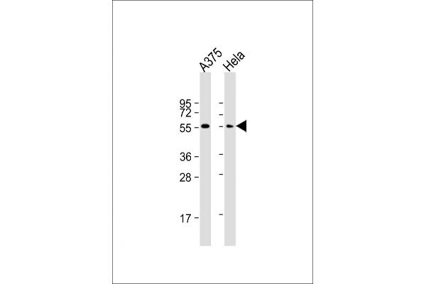 PTRF anticorps  (N-Term)