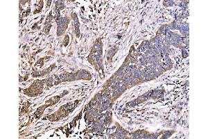 IHC analysis of MLX-interacting protein/MLXIP using anti-MLX-interacting protein/MLXIP antibody (ABIN7602593).