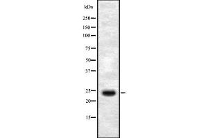 Western blot analysis SEI-1 using HepG2 whole cell lysates (SERTAD1 anticorps  (Internal Region))