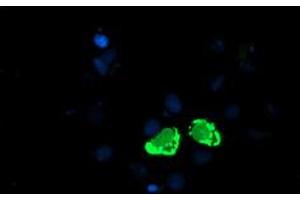 Anti-ENPEP mouse monoclonal antibody (ABIN2455323) immunofluorescent staining of COS7 cells transiently transfected by pCMV6-ENTRY ENPEP (RC210521). (ENPEP anticorps)
