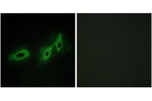 Immunofluorescence analysis of HeLa cells, using TRI18 Antibody. (MID1 anticorps  (AA 71-120))