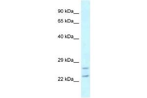 Western Blot showing RAB2A antibody used at a concentration of 1 ug/ml against MDA-MB-435S Cell Lysate (RAB2A anticorps  (C-Term))