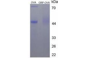 Image no. 3 for Gastrin-Releasing Peptide (GRP) peptide (Ovalbumin) (ABIN5666189)