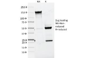 SDS-PAGE Analysis Purified MART-1 / Melan-A Mouse Monoclonal Antibody (A103). (MLANA anticorps)
