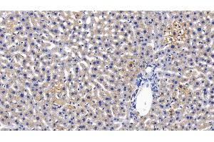 Detection of MBL in Mouse Liver Tissue using Polyclonal Antibody to Mannose Binding Lectin (MBL) (MBL2 anticorps  (AA 129-244))
