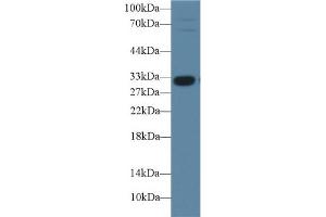 Detection of IGFBP1 in Porcine Liver lysate using Polyclonal Antibody to Insulin Like Growth Factor Binding Protein 1 (IGFBP1) (IGFBPI anticorps  (AA 112-262))