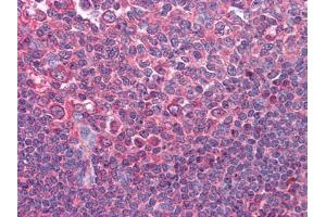 Immunohistochemical analysis of paraffin-embedded human Tonsil tissues using anti-CD80 mAb (CD80 anticorps)