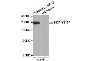 Western blot analysis of extracts of HUVE cells, using Phospho-KDR-Y1175 antibody (ABIN2988109). (VEGFR2/CD309 anticorps  (pTyr1175))