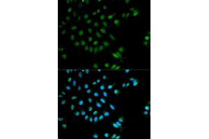 Immunofluorescence analysis of MCF-7 cells using XRCC2 antibody (ABIN5970910). (XRCC2 anticorps)