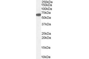 Image no. 1 for anti-Catalase (CAT) (Internal Region) antibody (ABIN374696) (Catalase anticorps  (Internal Region))
