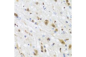 Immunohistochemistry of paraffin-embedded rat brain using HD antibody (ABIN6128012, ABIN6141669, ABIN6141672 and ABIN6213648) at dilution of 1:100 (40x lens).
