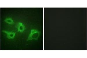 Immunofluorescence analysis of HeLa cells, using CKI-alpha Antibody. (CSNK1A1 anticorps  (AA 126-175))