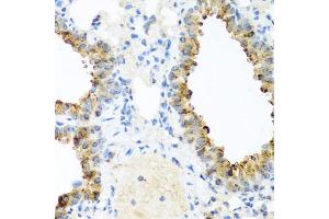 Immunohistochemistry of paraffin-embedded mouse lung using NIN antibody (ABIN6129422, ABIN6144630, ABIN6144632 and ABIN6224239) at dilution of 1:100 (40x lens). (Ninein anticorps  (AA 1-287))