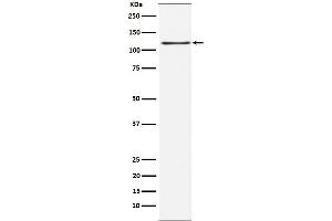 Western blot analysis of KSR1 expression in HEK293 cell lysate.