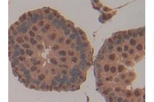 Detection of CD2AP in Rat Testis Tissue using Polyclonal Antibody to CD2 Associated Protein (CD2AP) (CD2AP anticorps  (AA 368-623))