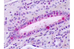 Anti-Latrophilin-3 / LPHN3 antibody IHC of human tonsil. (LPHN3 anticorps  (C-Term))