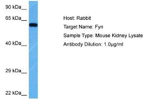 Host: Rabbit Target Name: FYN Sample Tissue: Mouse Kidney Antibody Dilution: 1ug/ml (FYN anticorps  (Middle Region))