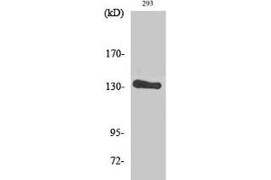 Western Blot analysis of 293 cells using ERBB2 Polyclonal Antibody at dilution of 1:2000. (ErbB2/Her2 anticorps)