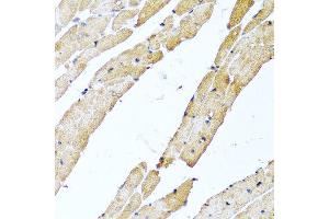 Immunohistochemistry of paraffin-embedded rat heart using CALCB antibody at dilution of 1:100 (40x lens). (CALCB anticorps)