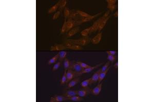Immunofluorescence analysis of NIH-3T3 cells using PIST/GOPC Rabbit mAb (ABIN1678809, ABIN1678808, ABIN7101325 and ABIN7101326) at dilution of 1:100 (40x lens). (GOPC anticorps)