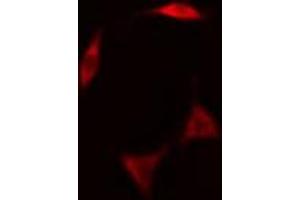 ABIN6268844 staining NCI-H460 cells by IF/ICC.