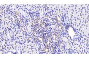 Detection of MAPK9 in Human Kidney Tissue using Polyclonal Antibody to Mitogen Activated Protein Kinase 9 (MAPK9)