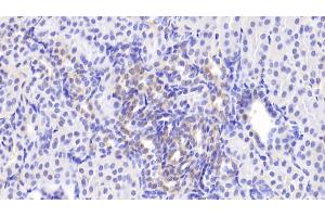 Detection of MAPK9 in Human Kidney Tissue using Polyclonal Antibody to Mitogen Activated Protein Kinase 9 (MAPK9) (JNK2 anticorps  (AA 130-387))