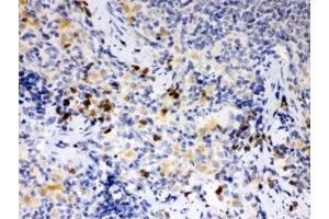 IHC testing of FFPE rat spleen with ATG14L antibody. (ATG14 anticorps)