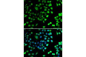 Immunofluorescence analysis of A549 cell using NTMT1 antibody. (METTL11A anticorps)