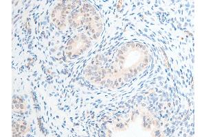 ABIN6267253 at 1/100 staining rat uterine tissue sections by IHC-P.