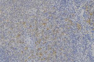 ABIN6273665 at 1/100 staining Human lymph node tissue by IHC-P. (IFNAR2 anticorps  (C-Term))