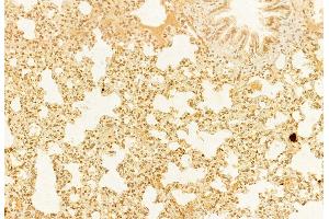 ABIN6264603 and ABIN6276542 at 1/100 staining Rat lung tissue by IHC-P.