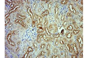 Paraformaldehyde-fixed, paraffin embedded Rat kidney; Antigen retrieval by boiling in sodium citrate buffer (pH6.