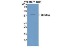 Western Blotting (WB) image for anti-Calcitonin (Calca) (AA 25-85) antibody (ABIN1172938) (Calcitonin anticorps  (AA 25-85))
