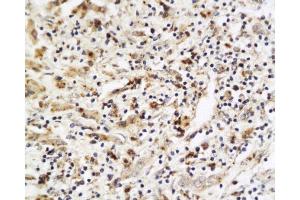 Immunohistochemistry (Paraffin-embedded Sections) (IHC (p)) image for anti-Placenta Growth Factor (PGF) (AA 166-221) antibody (ABIN727235) (PLGF anticorps  (AA 166-221))